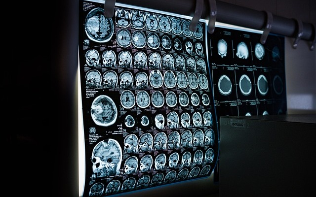 Healthcare AI Diagnostic Platform